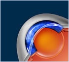 eye-cataract-surgery-diagram (1)