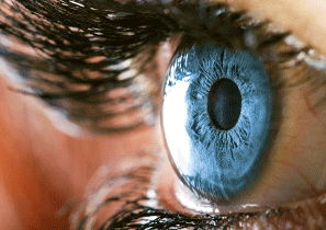 lasik-astigmatism